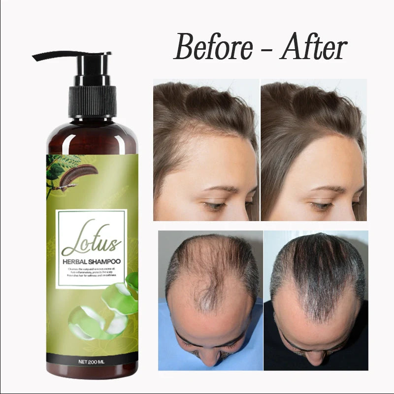Lotus Herbal Shampoo